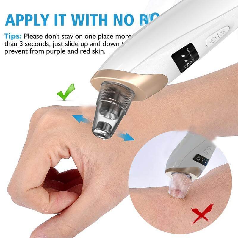 5 in 1 Electric Blackhead Remover Vacuum suction Face Pore Cleanser Facial beauty - Image 5